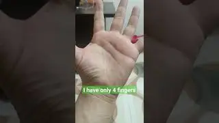 I have only 4 fingers #shorts