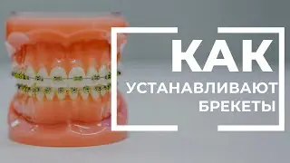 Этапы