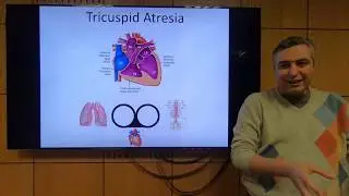 Single Ventricle (Part 1) - Hatem Hosny