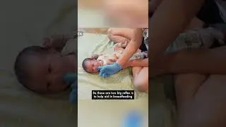 Newborn Reflexes: Rooting & Sucking