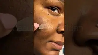 Pimple Patch Chronicles | why hello patch army #omg #pimplepatch