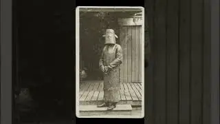 A Look Back: Creepy Vintage Medical Photos