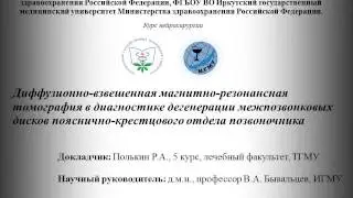 ДВ МРТ в диагностике дегенерации межпозвонковых дисков пояснично-крестцового отдела позвоночника