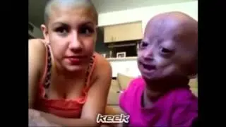ام تحلق شعرها لمساندة ابنتها - keek