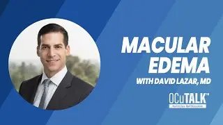 Macular Edema | What it is, Risk Factors, and Treatment Options with David Lazar, MD