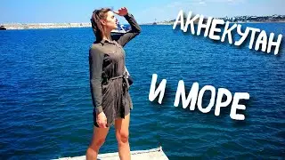 Совместим ли АКНЕКУТАН и отдых на МОРЕ? Вылечить прыщи.