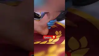 Филипп Косырев vs Заур Гаджиев Жёсткая Травма!