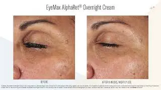 EyeMax AlphaRet® Overnight Cream Application Video
