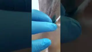 учимся менять внутреннюю трубку ( трахеостома)