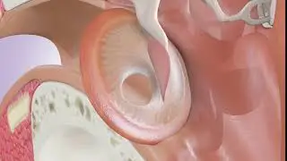 Tympanoplasty