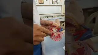 kidney model | kidney anatomy | spotting of kidney | @jj medicose