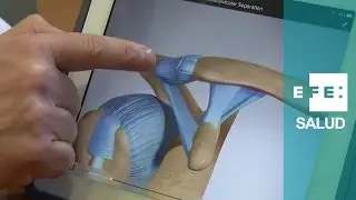 ¿Qué es una lesión acromioclavicular como la del madridista Marcelo?