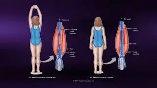 Causes of Muscle Soreness - Coursera Science of Exercise
