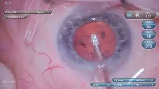 horizontal chop