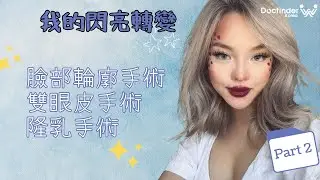 美國Youtuber珍妮佛 （Jennifer Vu）的不可思議整形之旅 二