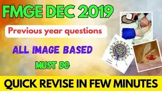 FMGE DECEMBER 2019 PREVIOUS YEAR image based questions revisions #fmge #neetpg #mbbs #next #fmge2023