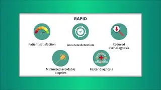 Speedy and Effective Diagnostic Pathway for Prostate Cancer