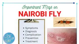 Nairobi Fly MCQs questions with answers।। Detailed epidemiology (symptoms, Complication, Treatment)