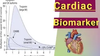 Cardiac Biomarker || pattern of cardiac Enzyme ||  Cardiac profile test