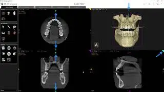 Planos Pestaña Corte Ortogonal | Carestream Imaging Software 3D