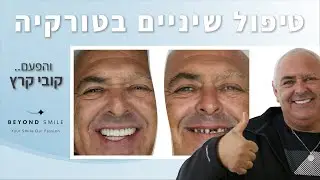 טיפולי שיניים בטורקיה עם ביונד סמייל - שיקום פה שלם של קובי קרץ