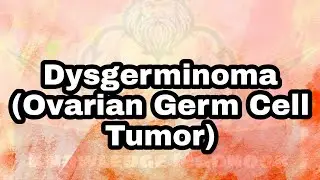 Dysgerminoma|Causes Riskfactors Symptoms|Diagnosis|4 Common Treatments