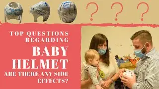 Baby Helmet for Flat Head (Plagiocephaly): Are There Any Side Effects?