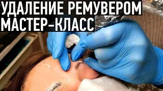 Tattoo removal with remover – a master class with Irina Tkachuk