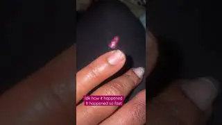 I was Shaving&the Shaver Slipped&Cut across my Real Nail🥴