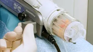 Mammotome Revolve™ Stereotactic Biopsy