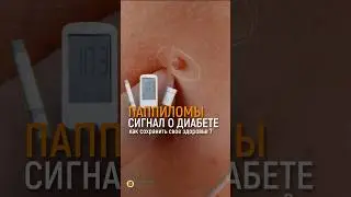 ПАППИЛОМЫ— СИГНАЛ САХАРНОГО ДИАБЕТА!