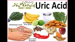Uric Acid ka Qudarti Ilaj in Urdu