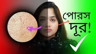 😯 ওপেন পোরস দূর করার নিশ্চিত বৈজ্ঞানিক উপায় । How To Get Rid Of Large Open Pores?