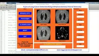 Types of Lung Cancer Identification Using Matlab Project With Source Code   Lung Cancer Type Detect