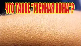 Что такое 
