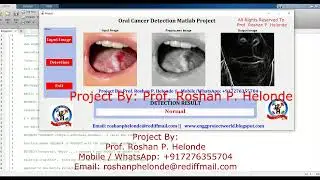 Oral Cancer Detection Using Deep Learning CNN | Matlab Project With Source Code Oral Cancer Predict