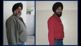 ਮੋਟਾਪਾ ਸਰਜਰੀ(Bariatric Surgrey)ਨੇ ਕਿਵੇਂ ਬਦਲੀ ਮੇਰੀ ਜਿੰਦਗੀ? 74kg ਭਾਰ ਘਟਣ ਤੋਂ ਬਾਅਦ ਮੇਰਾ 9 ਸਾਲਾਂ ਦਾ ਸਫਰ|
