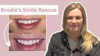 Brodie's Smile Rescue at Dentistry on the Square