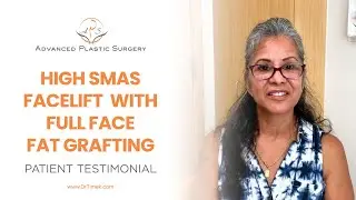 Patient testimonial - High SMAS facelift with full face fat grafting