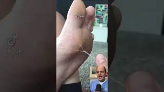 DOCTOR REACTS TO PERSON SUTURING OWN FOOT!😱 #shorts #reaction