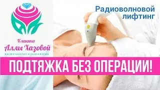 Подтяжка лица без операции! Фракционный RF-лифтинг. Коррекция овала лица. Радиоволновой лифтинг.