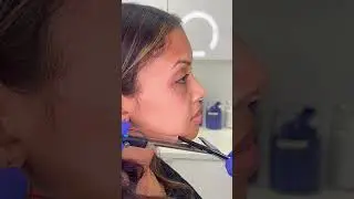 Non-surgical Chin Contouring