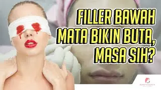 Filler bawah mata bikin buta, masa sih?