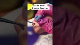 Mochi Pimple popping ASMR! Oddly satisfying