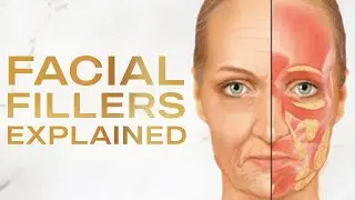 Facial Fillers Explained