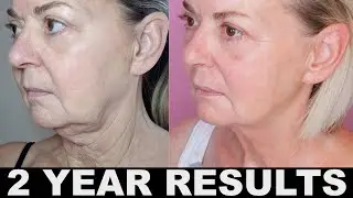 2 Year Anti-Aging Skincare Results Over 50 - Tighter, Firmer Skin