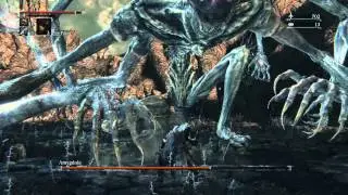 Amygdala: Frickin‘ Laser Beams
