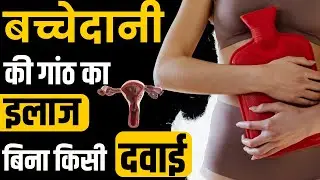 बच्चेदानी की गाँठ से पाए मुक्ति | Best Vitamin That Reduce Uterine Fibroid Size and Growth |