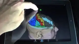 KiwiViewer Highlights