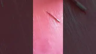 aplicativo do nano anestésico da MEU ZERO DOR #meuzerodor